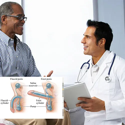 Welcome to   Surgery Center of Fremont 
: Understanding Penile Implant Surgery