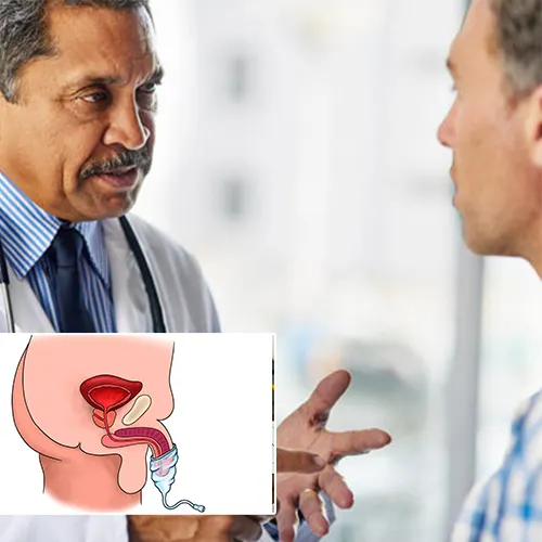 Preparing for Your Penile Implant Consultation with   Surgery Center of Fremont 
