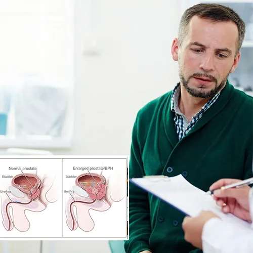 Transforming Lives with Advanced Penile Implant Techniques