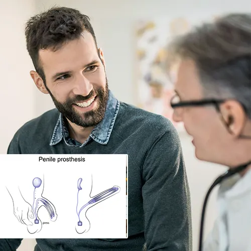 Why Choose   Surgery Center of Fremont 
for Your Penile Implant?